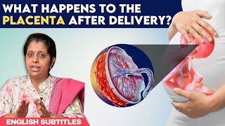 What happens to the placenta after delivery?