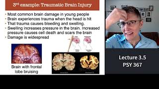 367 Lecture 3.5 Brain Diseases