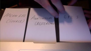 FMRI Coregistration Visual Demonstration