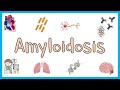Amyloidosis - Definition, Classification Systems, Types of Amyloidosis, Pathology & Clinical Aspects