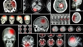 The Importance of Radiology - Dr.  Tayo Denton