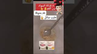 وصفة خطيرة لازالة السواد حول الفم 