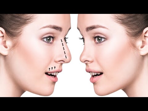 Video: Burnunuzu kiçiltməyin 3 yolu