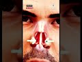احذر عادة بسيطة قد ت حدث ثقب ا في أنفك Shortvideo Explore Shorts Short احذر عادة بسيطة قد ت حدث ثقب ا في أنفك Shortvideo Explore Shorts Short