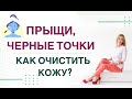 ❤️ ПРЫЩИ, ЧЕРНЫЕ ТОЧКИ… КАК ОЧИСТИТЬ КОЖУ❓ ГОРМОНЫ И КОЖА Врач эндокринолог, диетолог Ольга Павлова.