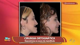 Saiba mais sobre o processo de recuperação da cirurgia ortognática