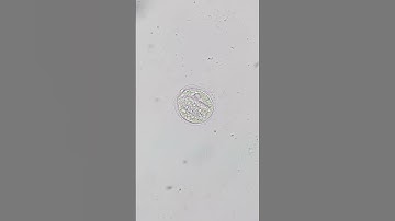 Ciliate comes out of it´s cyst (part 3)  #microscopy #science