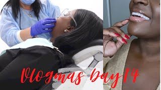 VLOGMAS DAY 14 | FINALLY SHOWING MY NEW SMILE + SMILE MAKEOVER | Nadula Hair