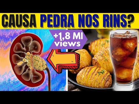 PEDRA NO RIM: 8 DICAS PARA NUNCA MAIS TER CÓLICA RENAL