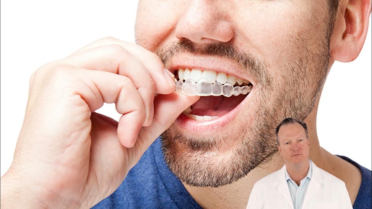 Invisalign Express (одна челюсть)