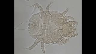 Walking dandruff mites in dogs
