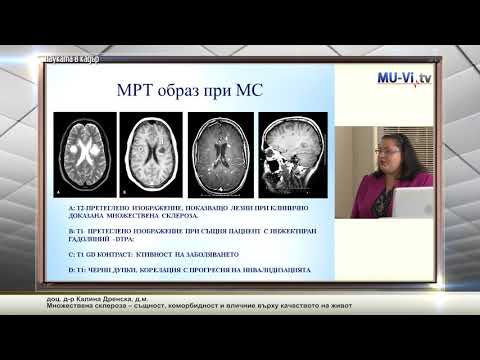 Множествена склероза – същност, коморбидност и влияние върху качеството на живот