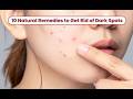 Remove Acne & Dark Spots Fast at Home (Simple Routine - Glow Theory