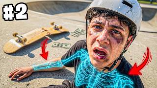 Kaykay Sürerken EN FAZLA Kaç Kemiğimi Kırabilirim? #2 🦴🛹 | EmirhanCTN