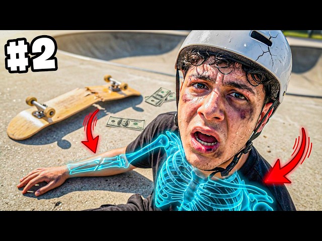 Kaykay Sürerken EN FAZLA Kaç Kemiğimi Kırabilirim? #2 🦴🛹 | EmirhanCTN