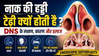 नाक हमेशा बंद रहती है? कहीं DNS तो नहीं! जानें कारण, लक्षण और इलाज | Dr. Sunil Tanvar