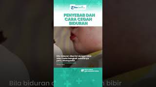Bikin Gatal hingga Bentol, Biduran yang Tak Segera Diatasi Bisa Picu Komplikasi, Kenali Penyebabnya