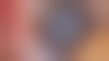 Properly Decompressing White Mature/Intumescent Cataracts with Dr. Stephen Tate