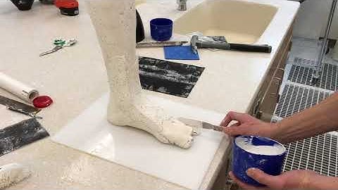 AFO Cast Modifications1