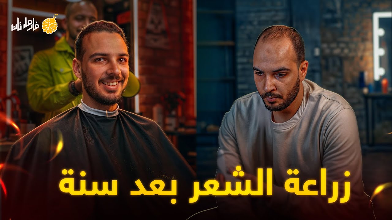 فارماستان - تجربتي الكاملة مع زراعة الشعر و النتيجة بعد سنة | العملية بكام؟