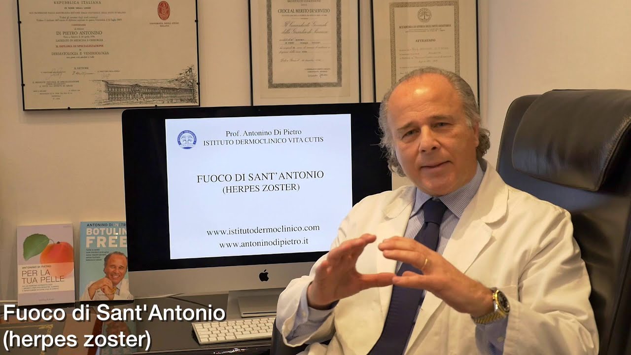 Fuoco di Sant'Antonio (Herpes Zoster)