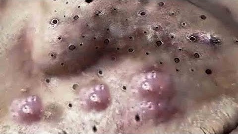 When you reach the end of your rope, tie a knot in it and hang on #215