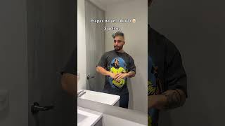 Todo Calvo Paso Por Esto