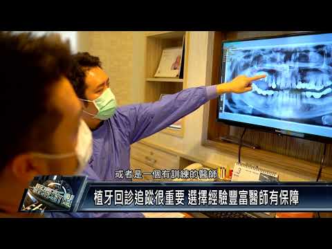 南臺灣/衛生醫療 111 0309 避免成為「植牙孤兒」慎選信譽良好的品牌