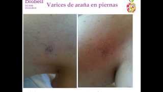 Araña venas dermablend de