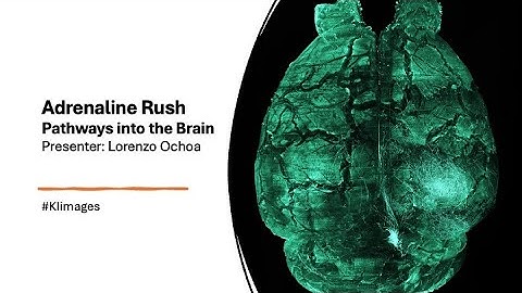 2025 Image Awards Lightning Talks - Adrenaline Rush