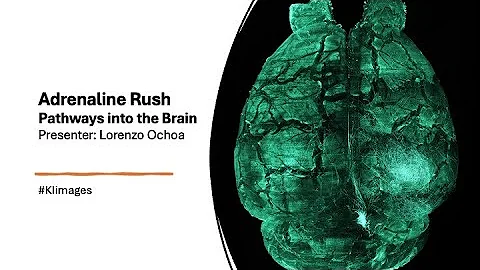 2025 Image Awards Lightning Talks - Adrenaline Rush