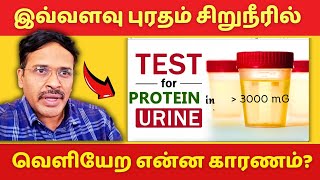 சிறுநீரில் புரதம் வெளியேறுவது ஏன்? | kidney failure treatment? proteinuria!