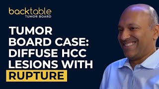 HCC Tumor Board Case 6: Diffuse HCC Lesions with Rupture