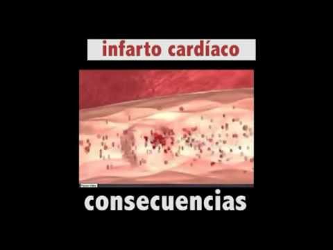 higado graso causas y efectos higado graso causas y efectos