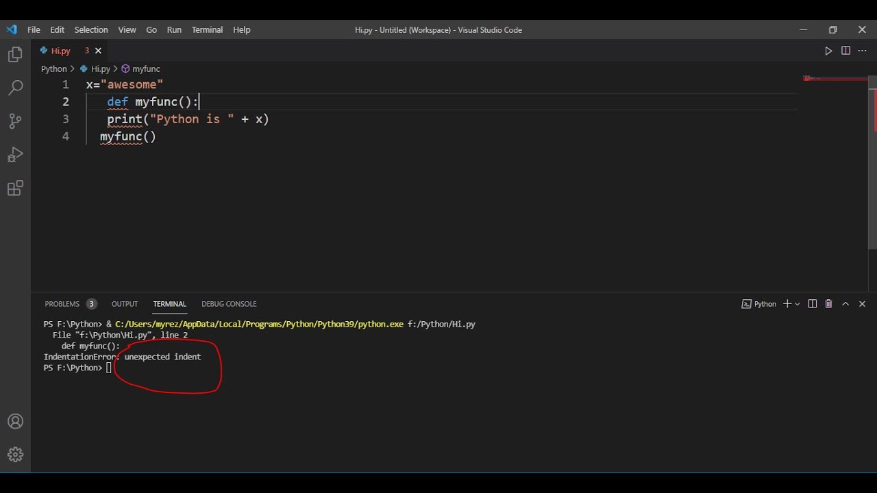 Indentationerror: Unexpected Indent   Problem Solve Python Vscode