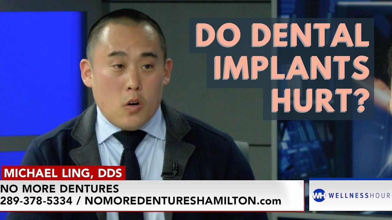 Do dental implants hurt? Dental Implants, All On 4, All On X No