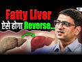 Fatty Liver को Healthy रखने का सबसे आसान Formula! | Dr. Ankur Garg | Gut Health | Josh Talks Hindi