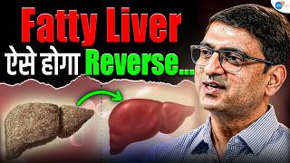 Fatty Liver को Healthy रखने का सबसे आसान Formula! | Dr. Ankur Garg | Gut Health | Josh Talks Hindi