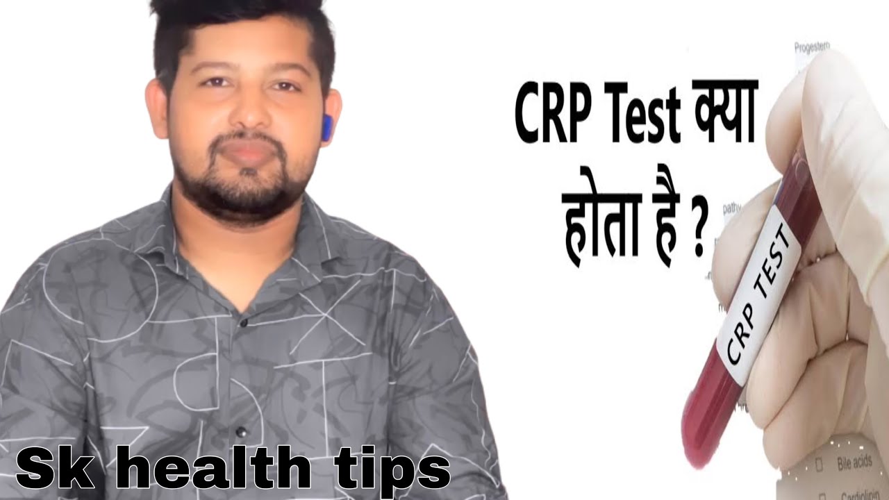 WHAT IS CRP TEST CRP TEST KYA HOTA HAI SK HEALTH TIPS YouTube what-is-crp-test-crp-test-kya-hota-hai-sk-health-tips-youtube