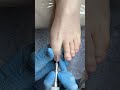 Pedicure │ Fingers treatment