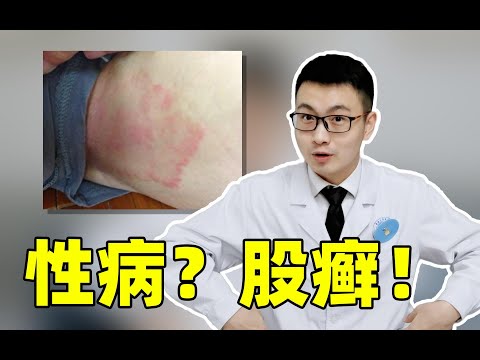 大腿根发黑、瘙痒难耐，是性病还是股癣？得了股癣怎么办？