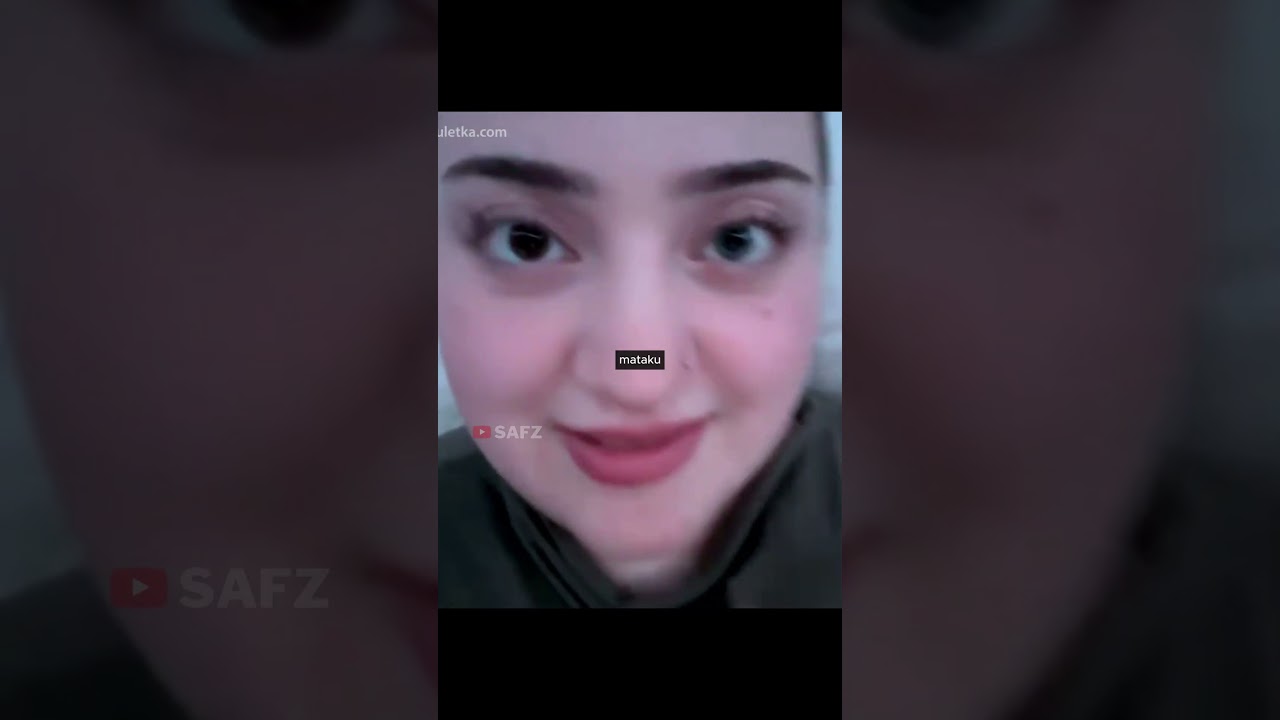 Wow.. Ini dia pemilik mata langka di dunia!