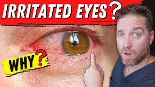 6 Top Causes Of IRRITATED EYES! - Tips For Relief