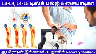 L3-L4,L4-L5 disc bulge | Sciatica | ஆபரேஷன் இல்லாமல் தீர்வு