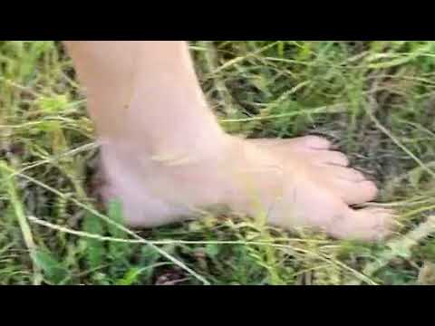 Should we be afraid of walking barefoot?