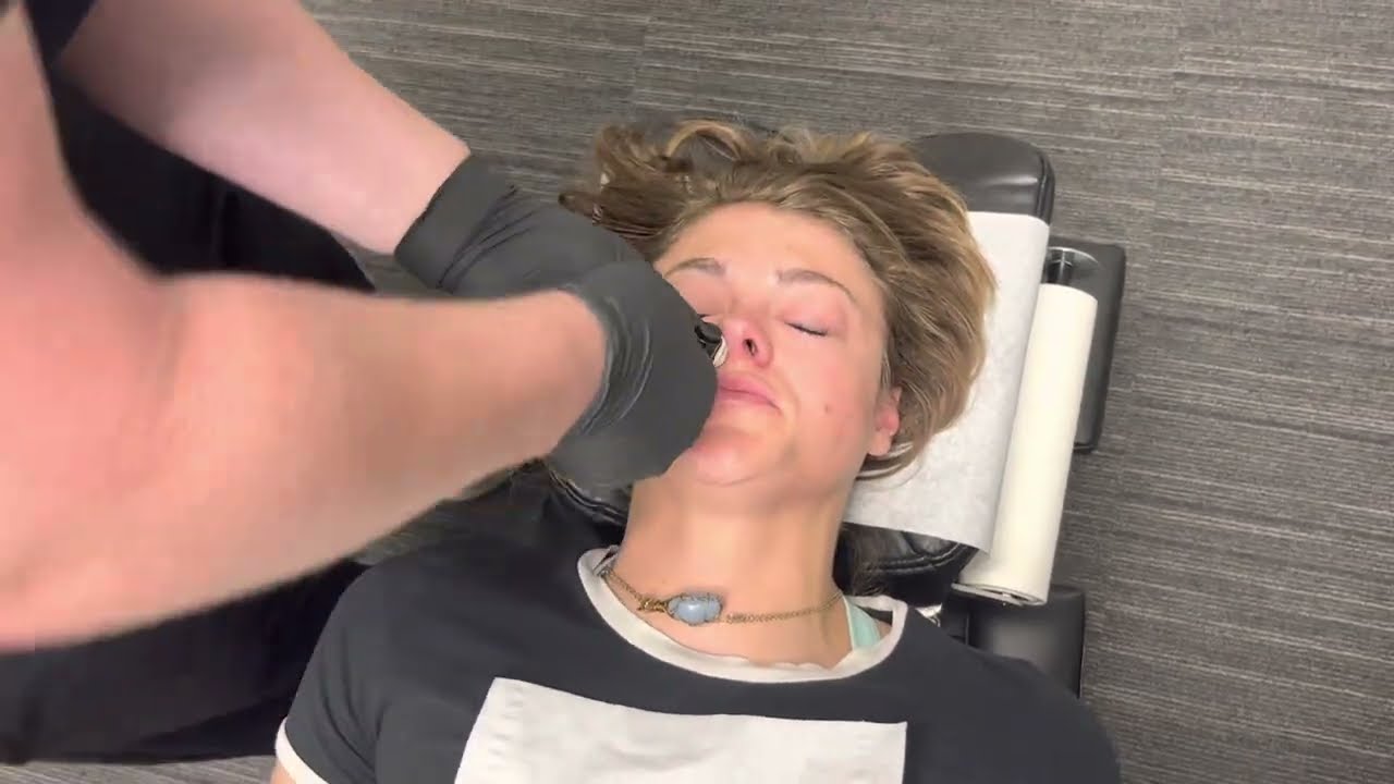 What does Nasal specific technique look like?