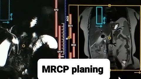 MRCP planing (1.5T Siemens machine)