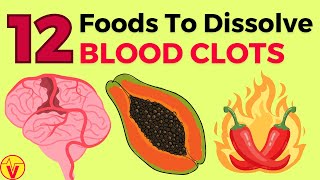 12 Foods That Dissolve Blood Clots Naturally (Doctors WON'T Tell You) | VisitJoy