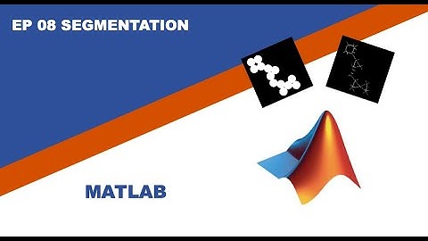 Matlab Segmentation
