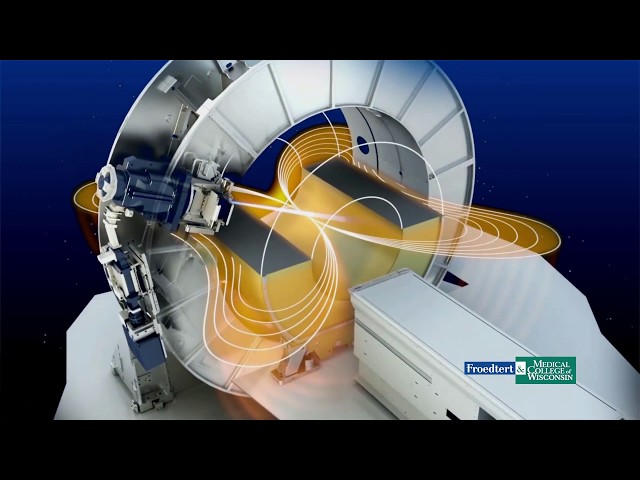 Watch MR-Linac (Christopher Schultz, MD) on YouTube.